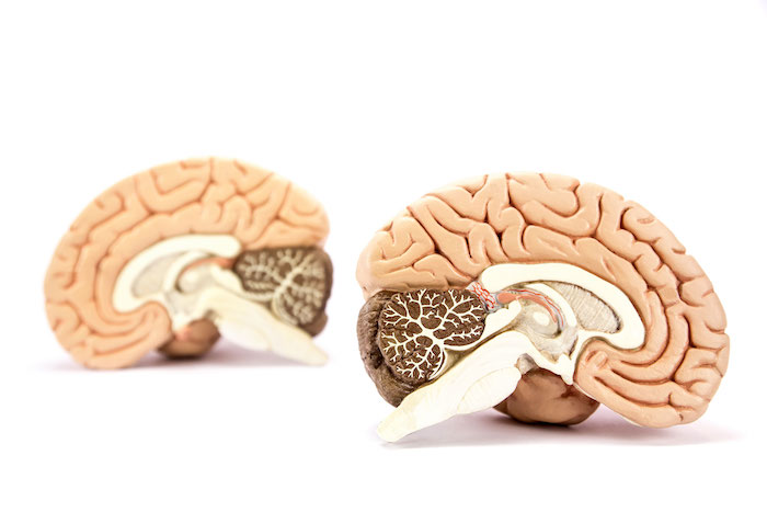 Lateral/Medial brain diagram with both hemispheres