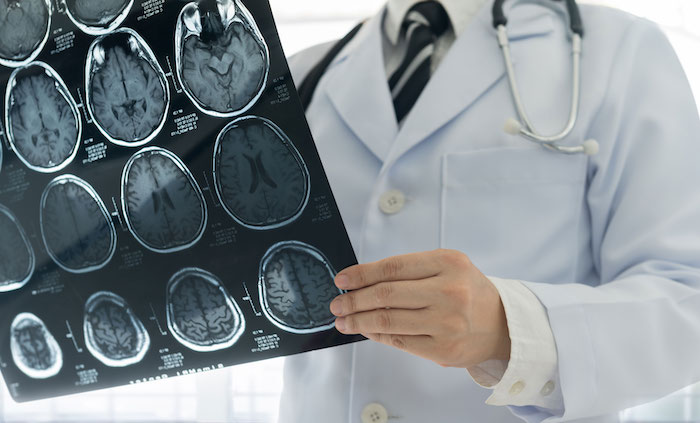 Doctor holding brain scan